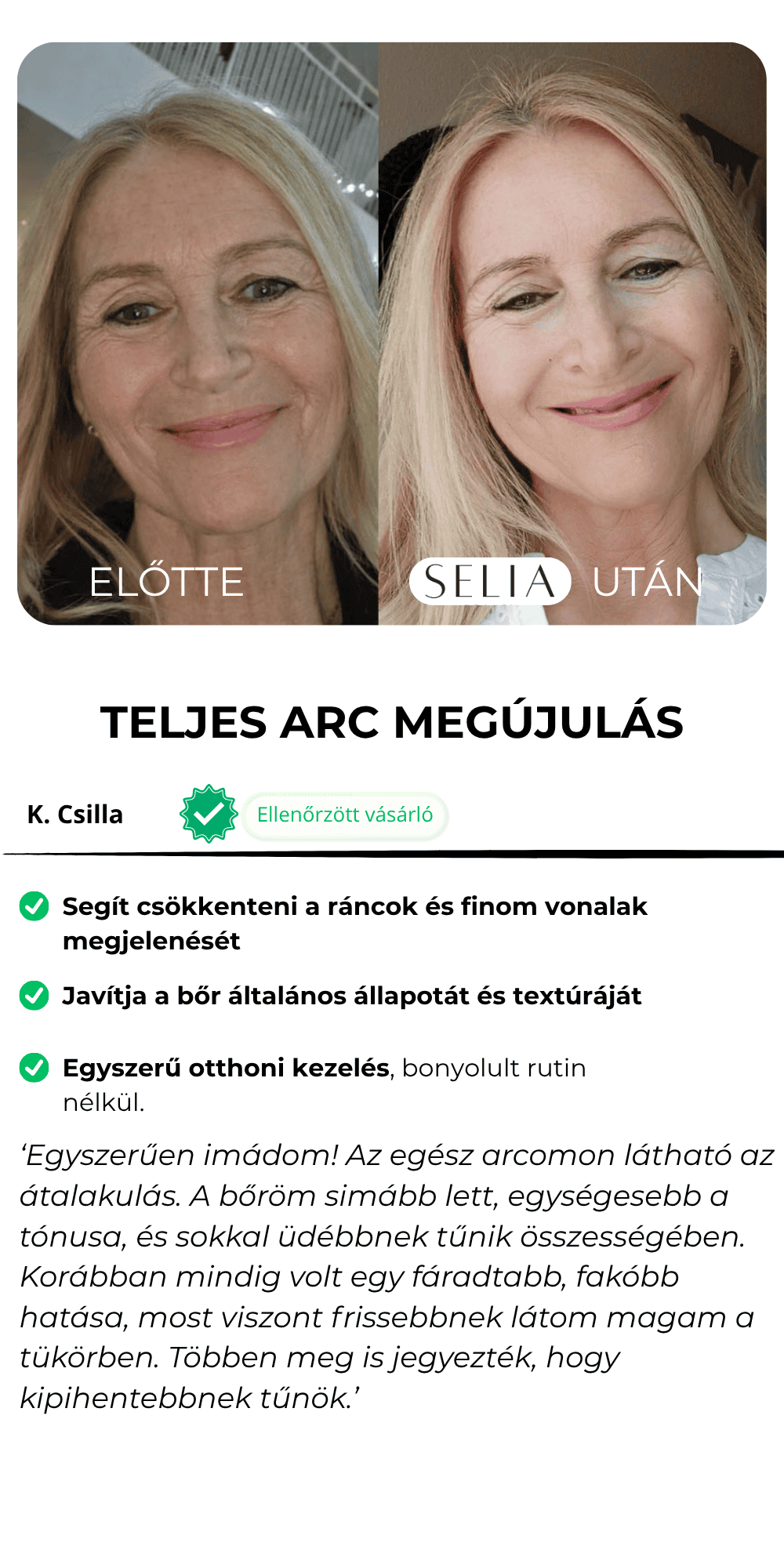 Előtte-Utána Selia Beauty (1)