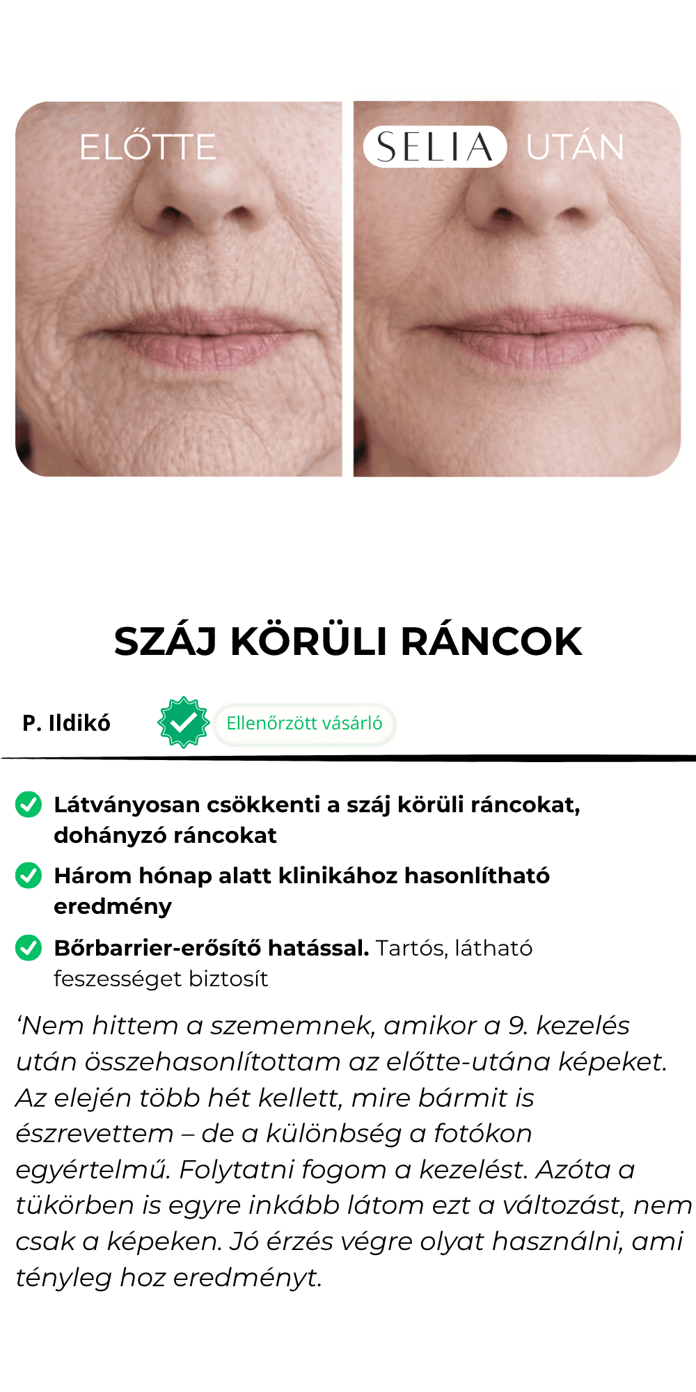 Előtte-Utána Selia Beauty