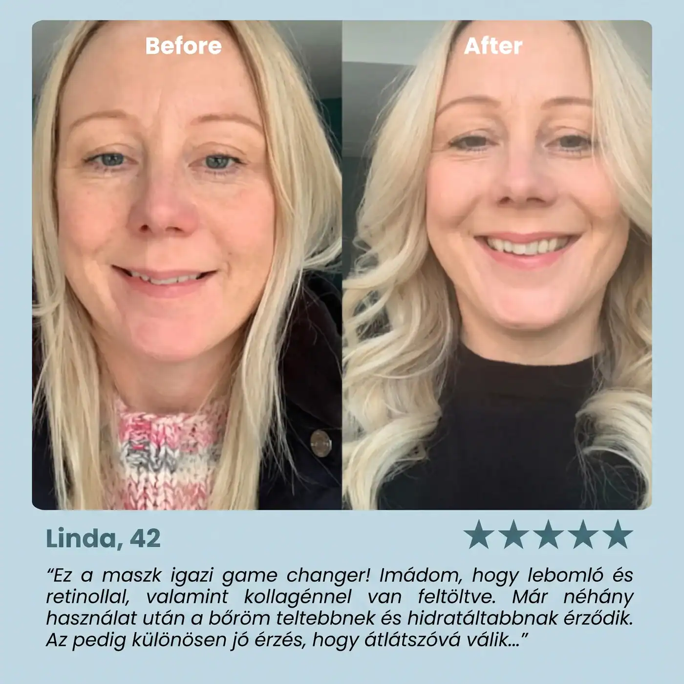 Linda, 42 — előtte és utána a Selia Bio-Kollagén Maszkkal