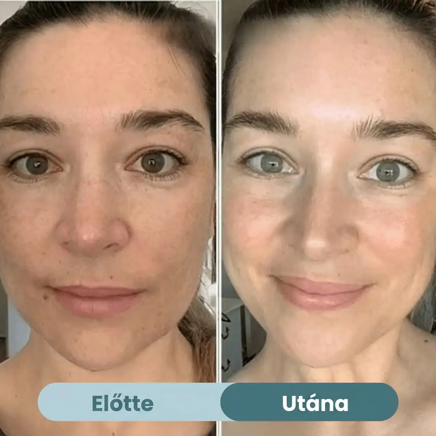 Előtte és utána — Selia Bio-Kollagén Maszk